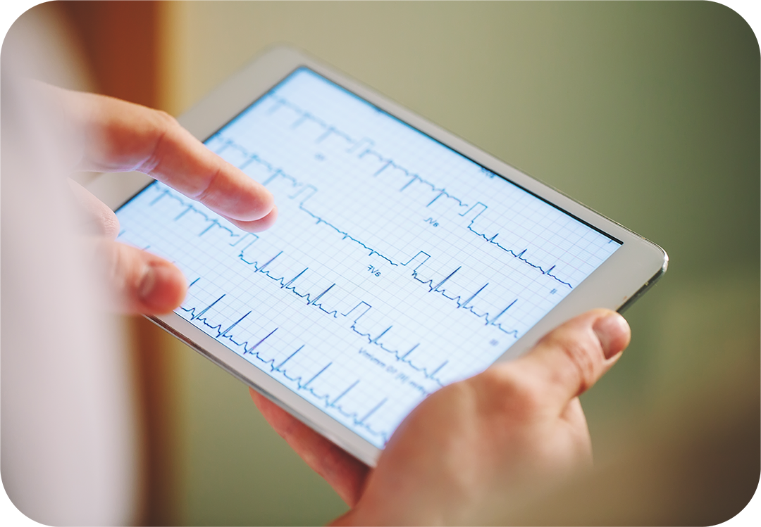 electrocardiograma